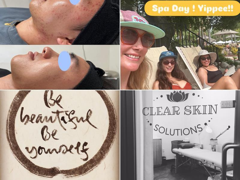 Clear Skin Solutions