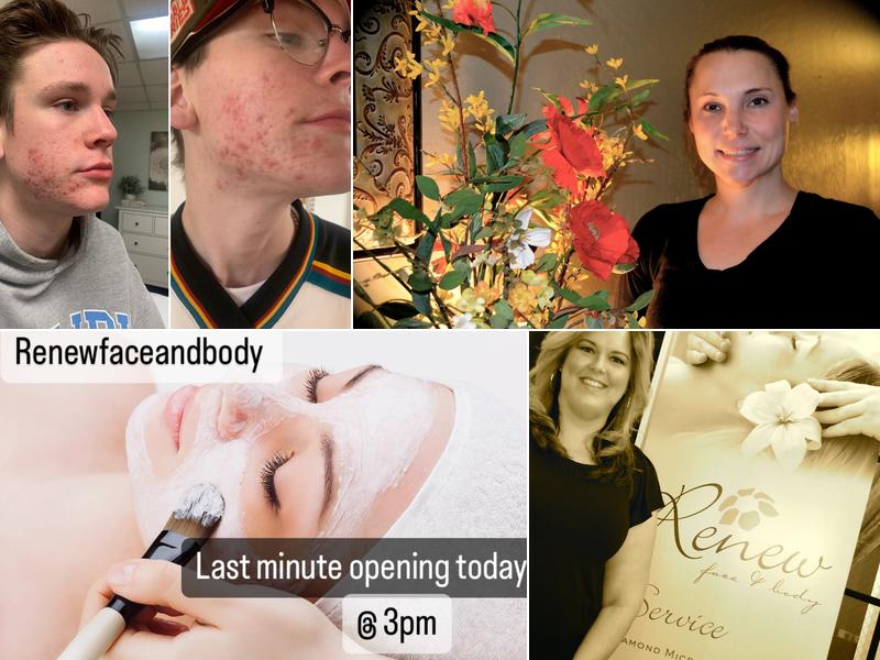 Renew Face & Body