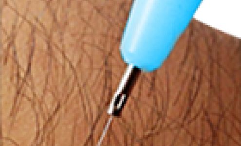 Marci Coffey - Specialist in Permanent Hair Removal & Electrolysis Camarillo