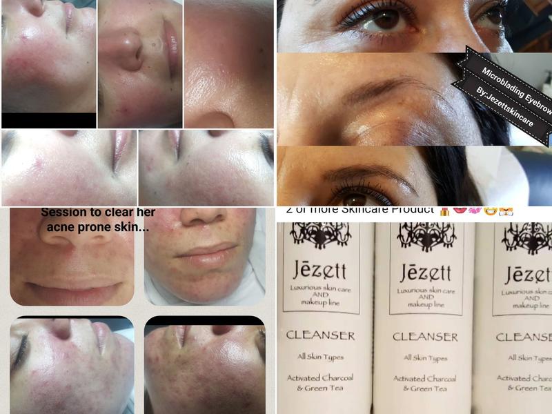 Jézett Skin Care