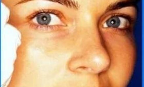 John F. Alburger, M.D.,