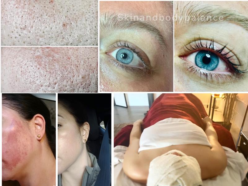 Skin and Body Balance