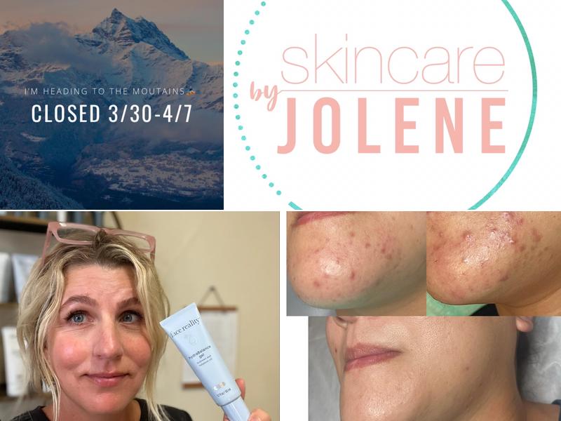 Skincare By Jolene