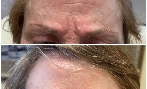 Prolase Medispa - Fairfax location