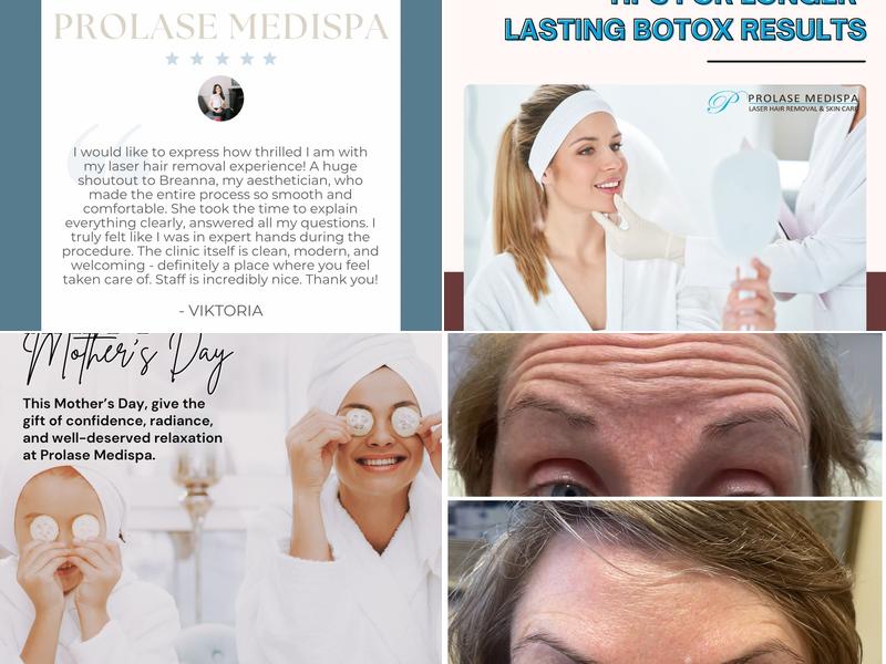Prolase Medispa