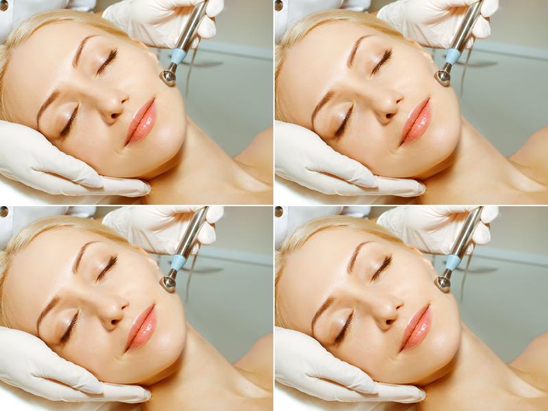 Geraldine Pape Rand Electrolysis Laser And Esthetics