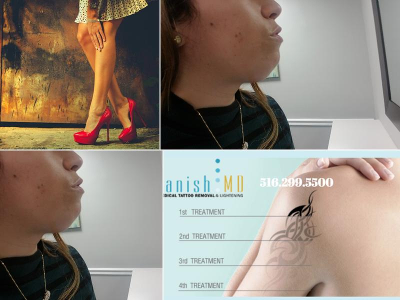 Island Medical Laser: Wayne Wertheim, M.D.