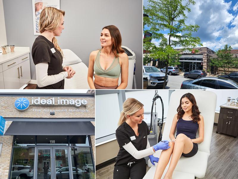 Ideal Image King of Prussia