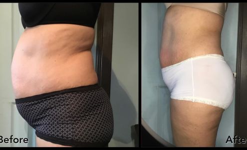 About Faces Skincare