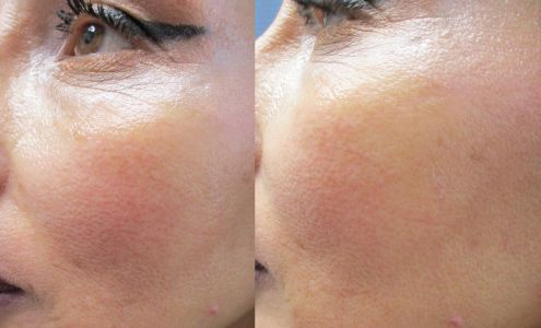 MD Wellness Center and Med Spa, Indianapolis