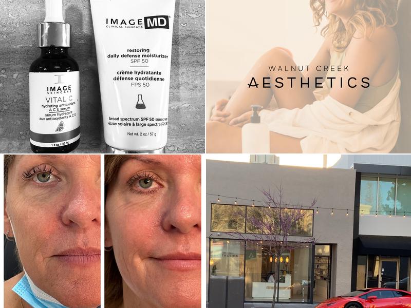 Walnut Creek Aesthetics