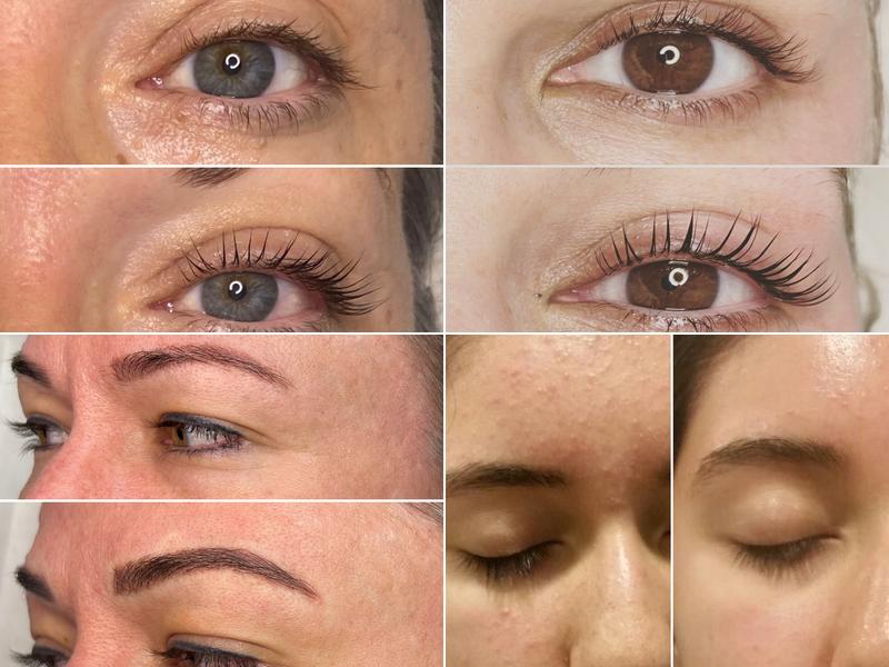 Skin. By Beth Ann Warren