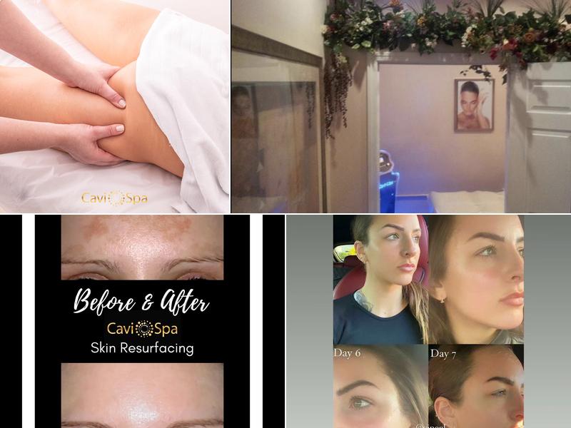 Cavi Med Spa