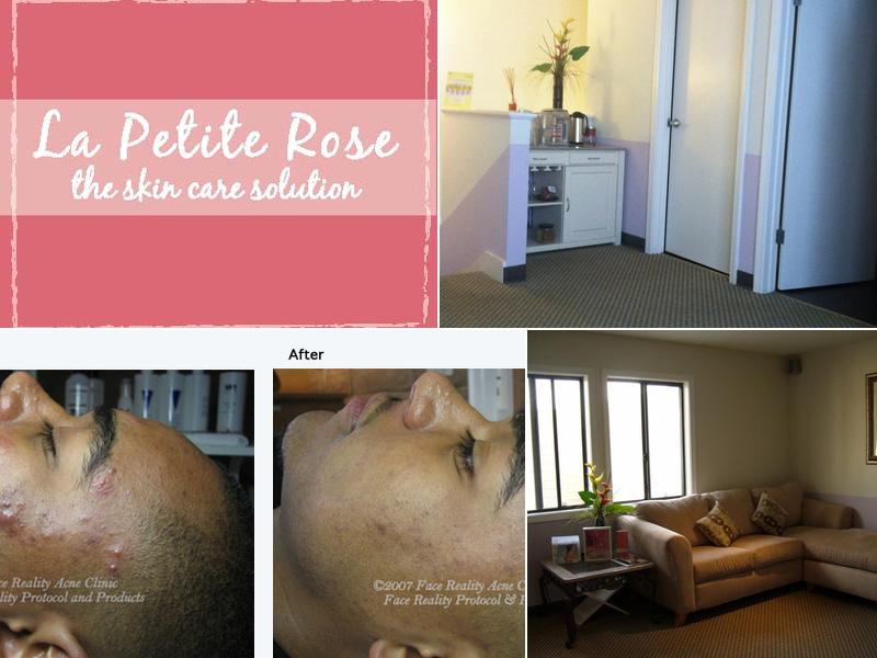 La Petite Rose skincare & acne solution