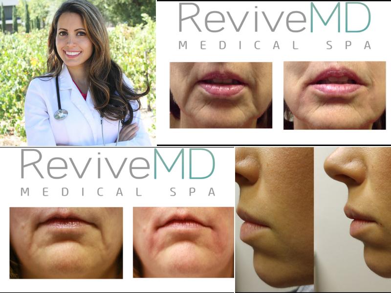 ReviveMD - IV Drip Spa, Concierge Medicine, Aesthetics