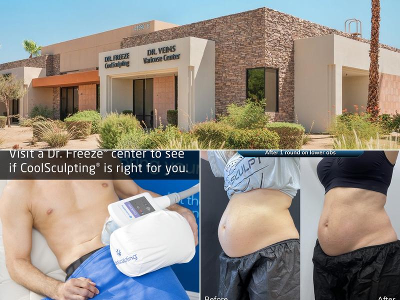 Dr. Freeze CoolSculpting Center - Palm Desert