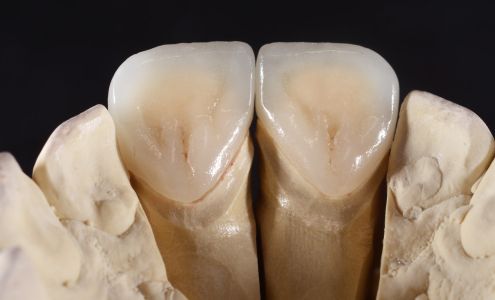 Aesthetic Dsign Dental Laboratory