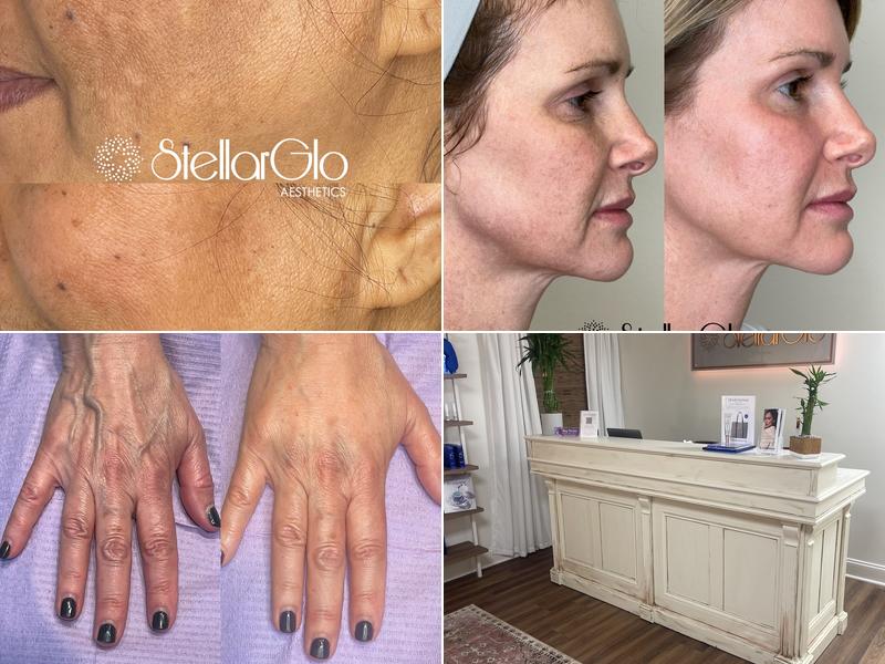 Stellarglo Aesthetics