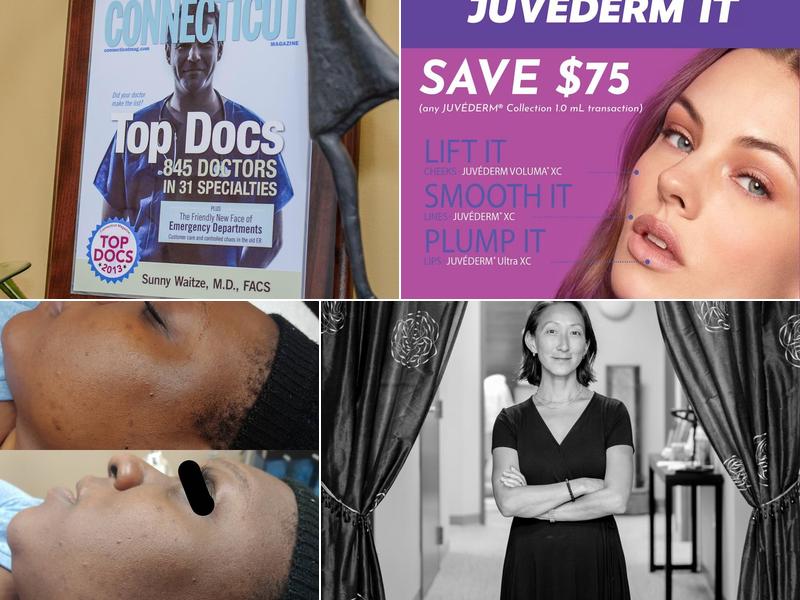 Pomperaug Plastic Surgery