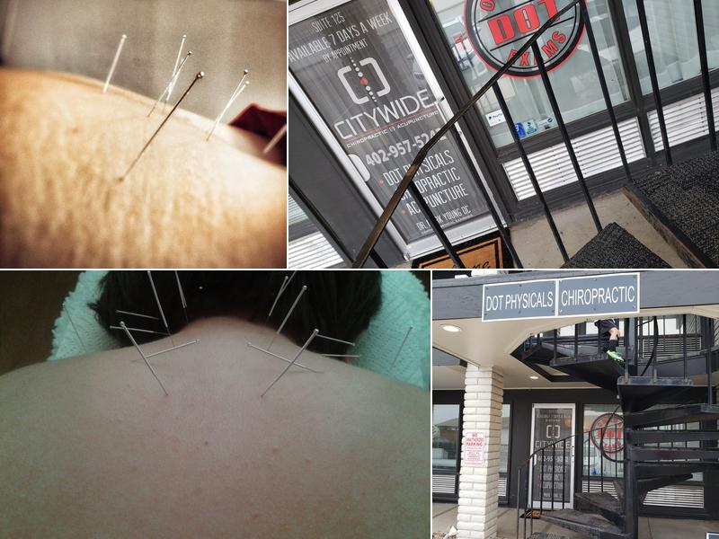 Citywide Chiropractic and Acupuncture