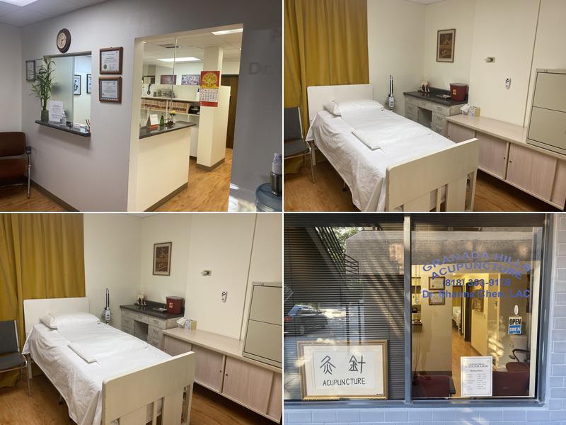 Granada Hills Acupuncture Shanna Chen