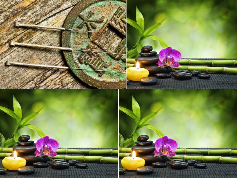 Stepping Stone Acupuncture & Wellness