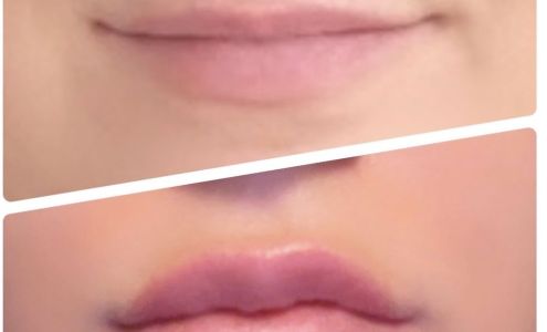 Simply Injectables