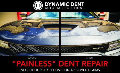 Dynamic Dent Removal