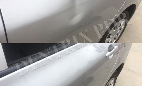 DenTrix Paintless Dent Removal