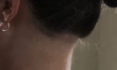 Aesthetic Laser Corp