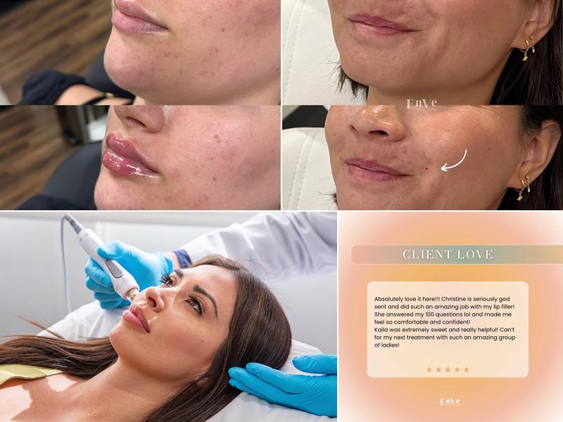 Enve California Aesthetics