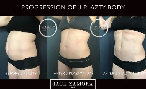 Jack Zamora MD Cosmetic Surgery and Aesthetics