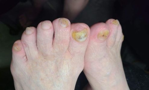 Hygeian Hand and Foot Refinery