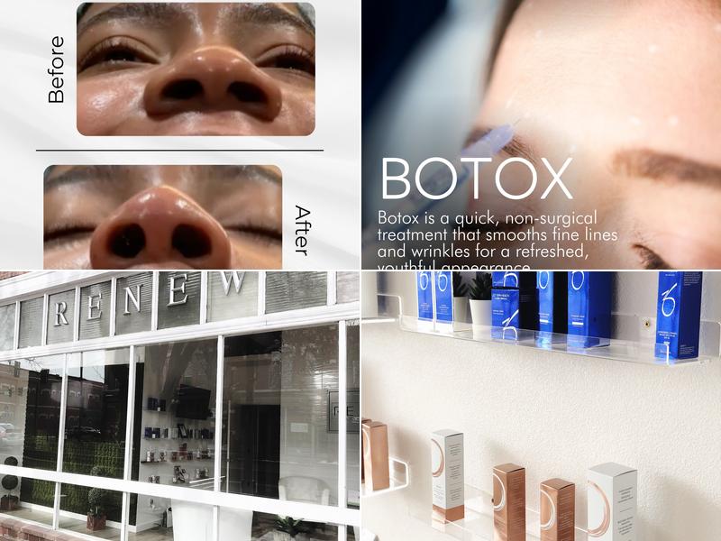 Renew Medical Spa • Laser • Wellness