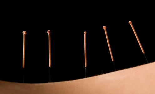 Tricia L. Mattson L.Ac - TCM Acupuncture Canon City, CO