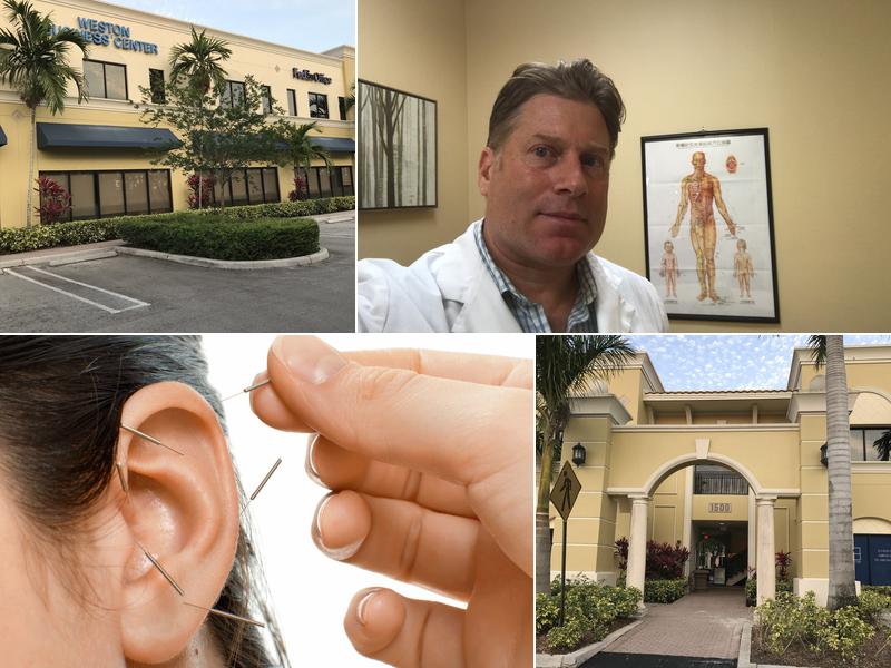 Acupuncture of Weston