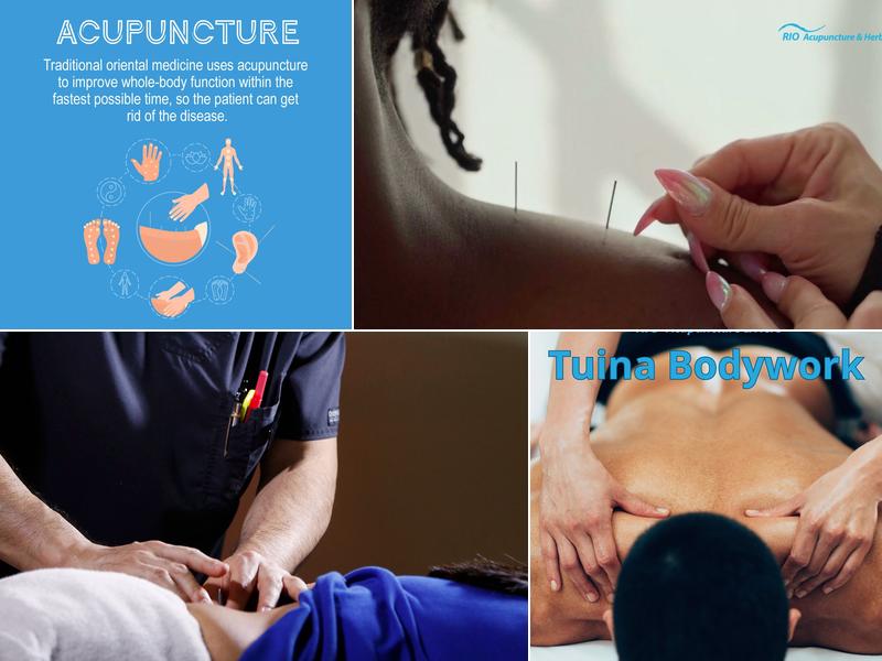 Rio Acupuncture | Back Pain,Sciatic Nerve Pain,Hip Joint Pain,Neck Pain,Rotating Cuff Shoulder Pain, Stress, Insomnia.