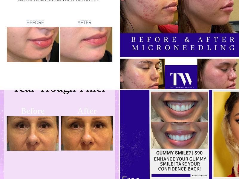 Shahnaz Kazerooni, RN