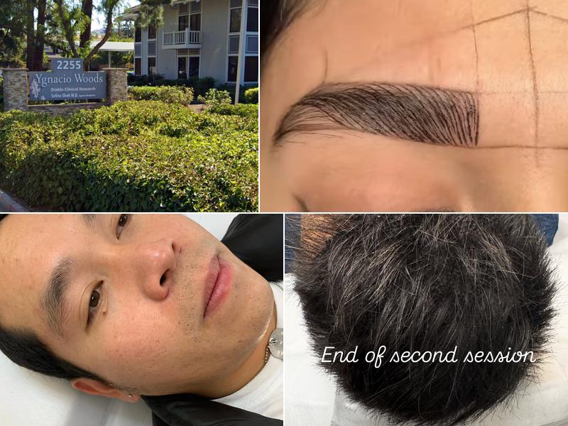 Leblanc Facial Spa, Microblading, Scalp micropigmentation