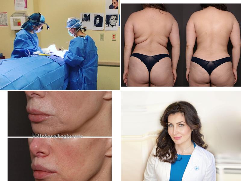 Sara Yegiyants MD FACS