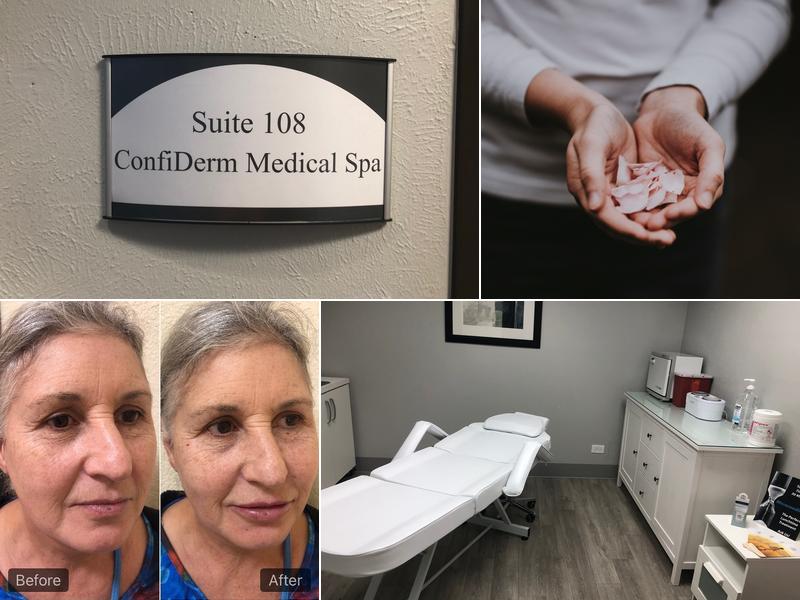 ConfiDerm Medical Spa