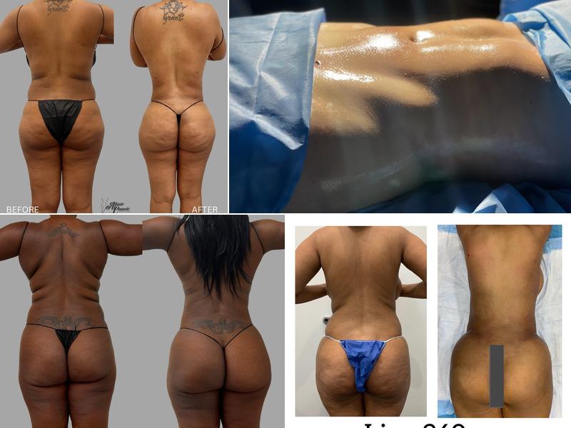 Atlantic Cosmetic Surgery and Medspa