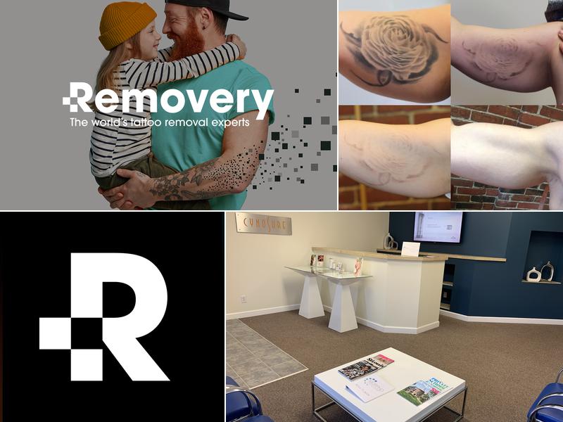 Removery Tattoo Removal & Fading