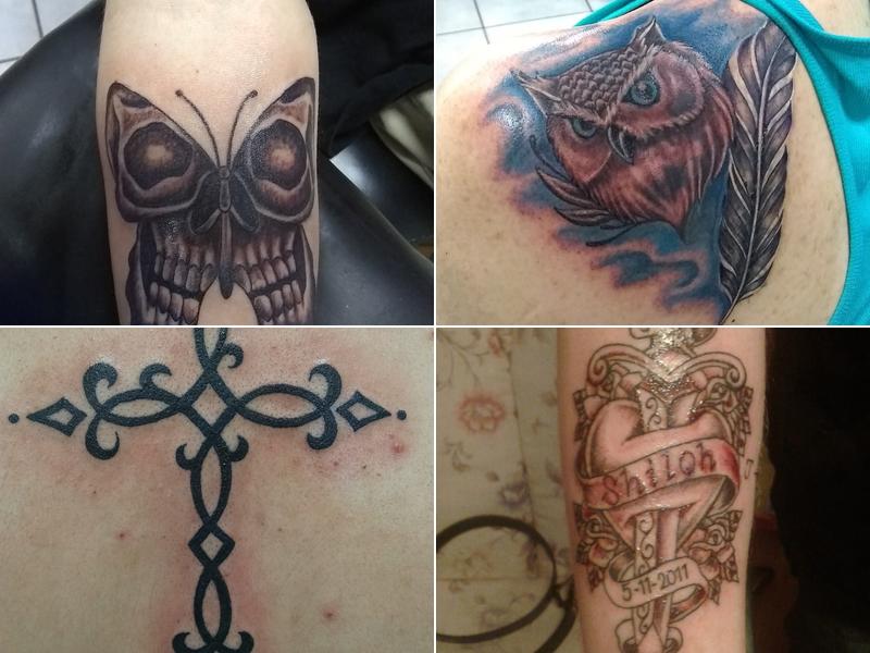 Intradermal Designs