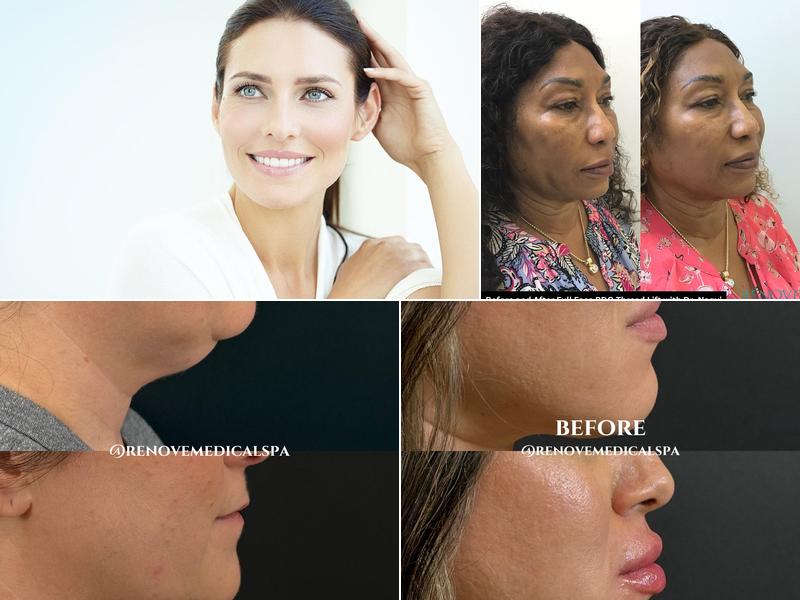 Renove Medical Spa