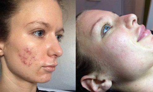 Advanced Skin Care Solutions