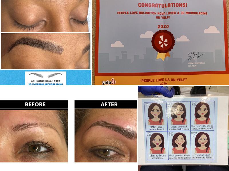 Arlington NOVA LASER & 3D MICROBLADING
