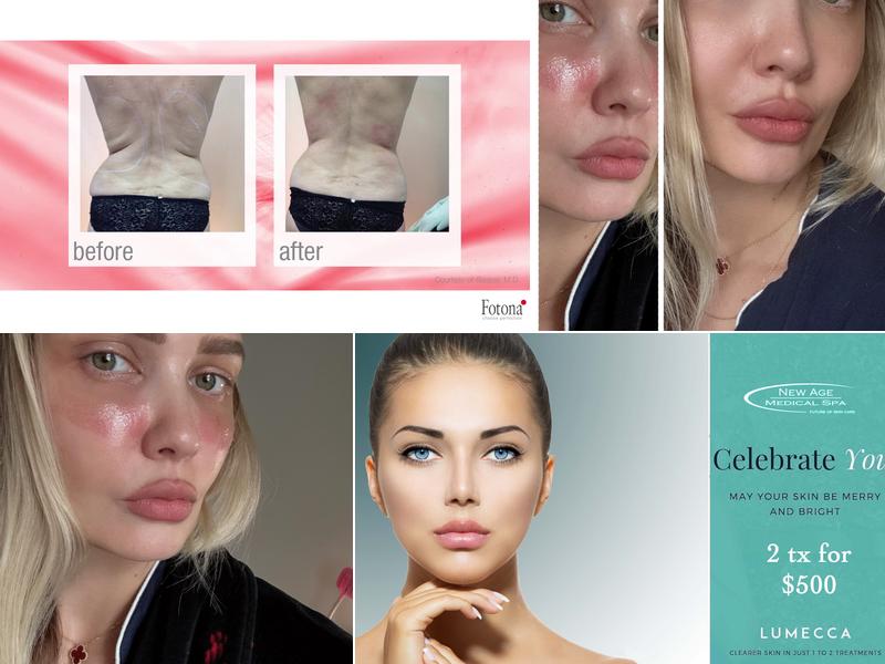 New Age Laser Clinic