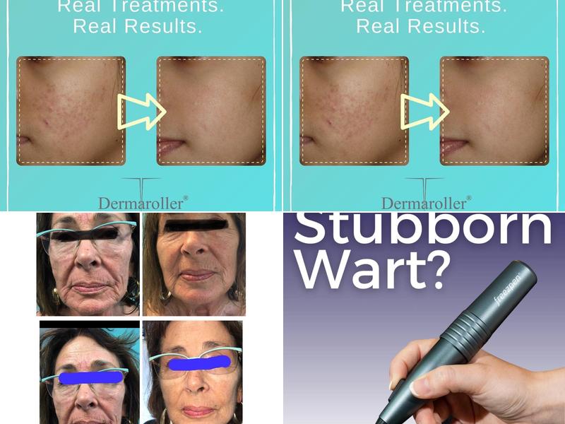 Total Body Laser Clinic