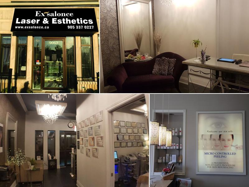 Exsalonce Laser & Esthetics